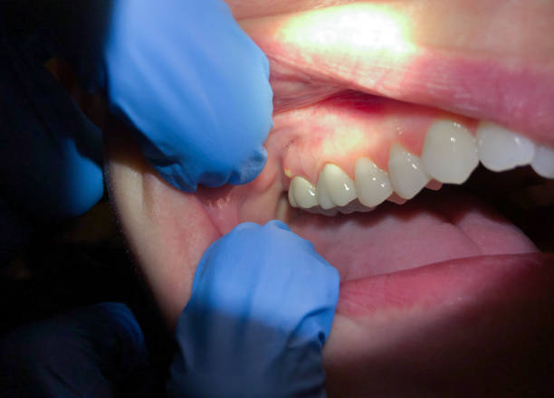 Best Emergency TMJ Treatment in Percy, IL