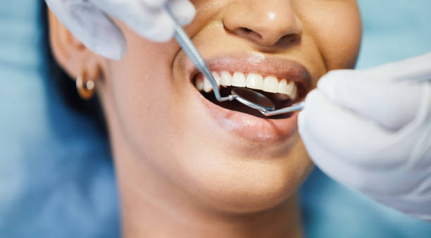 Best Same-Day Emergency Dental Services in Percy, IL