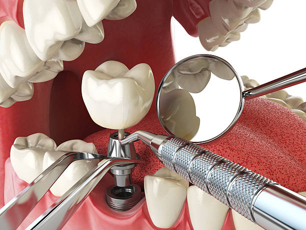 Best Emergency TMJ Treatment in Percy, IL
